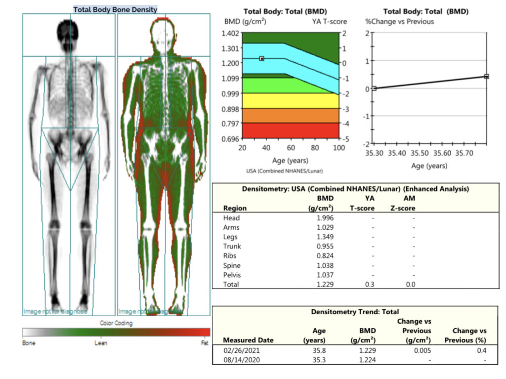 Body composition with dexascan
